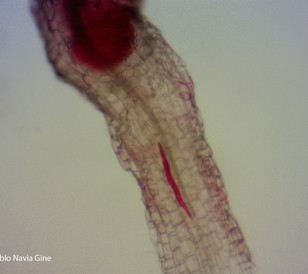 Cotton root-knot (Meloidogyne incognita) juvenile
