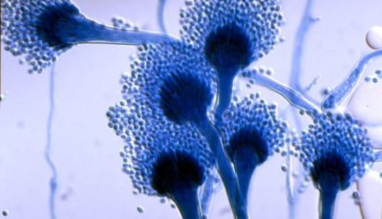 Aspergillus fumigatus