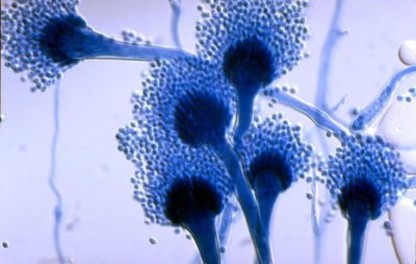 Aspergillus fumigatus