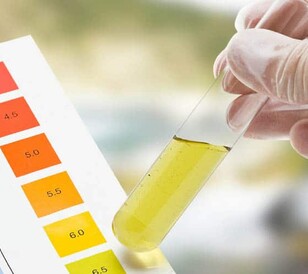 PARÁMETROS FISICOQUÍMICOS