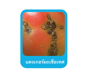 Mastercop โรค-05
